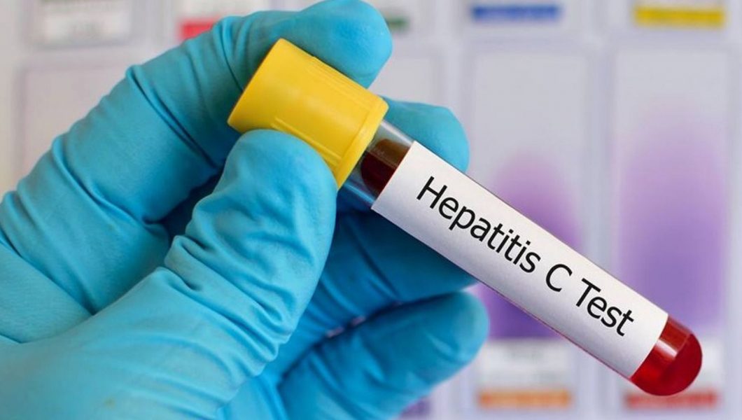 Cum se transmite hepatita C