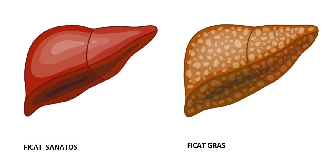 Alimente nerecomandate in cazul ficatului gras