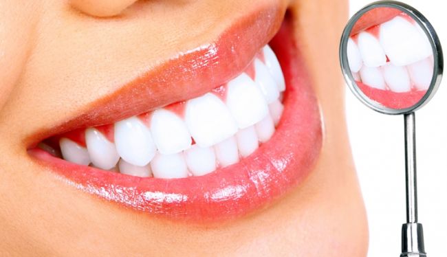 Este clar pentru toata lumea ca pentru dinti albi si stralucitori trebuie sa optezi pentru metode de albire dentara profesionale