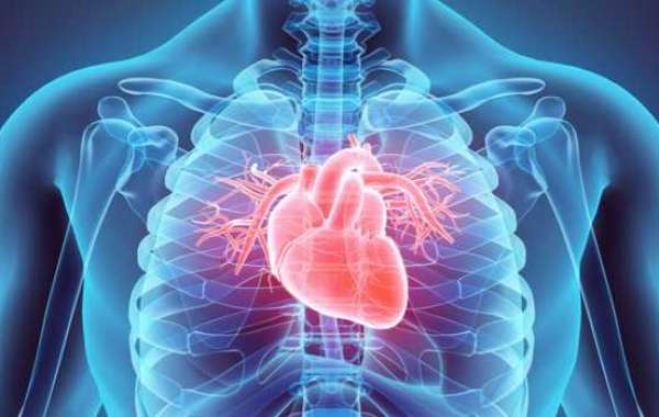 Atacul de cord silentios sau infarctul pe care nu stii ca l-ai avut