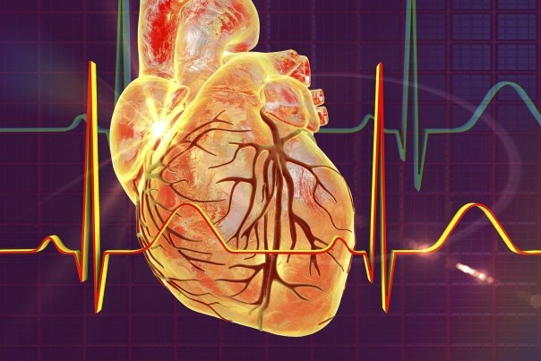 Ce nu este cardiopatia ischemica