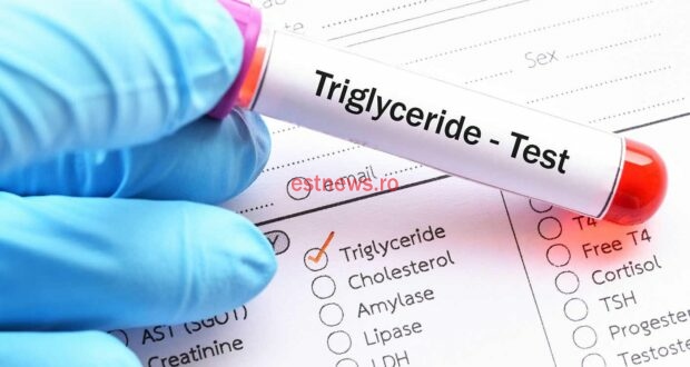 trigliceride